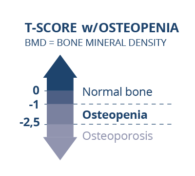 What is, and how do you get osteopenia? | REGOROS.eu